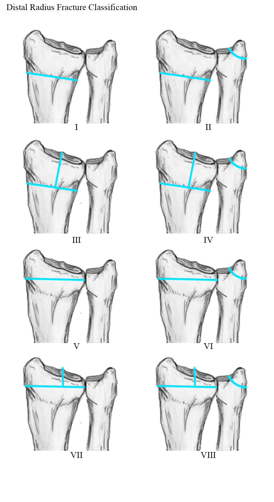 Frykman Classification