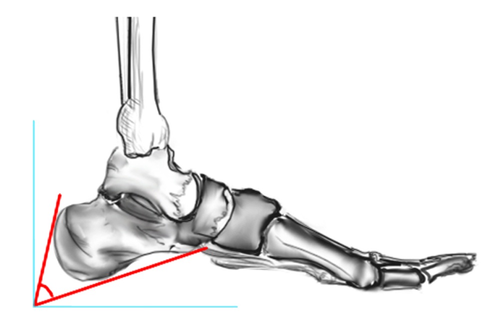 Fowler's Angle