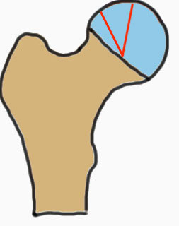 Kerboul angle 1