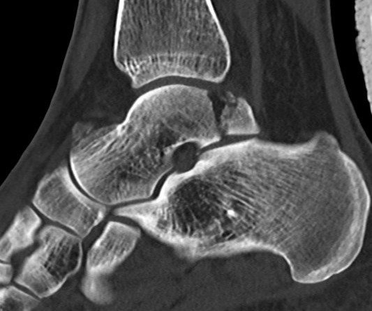 Posterior process