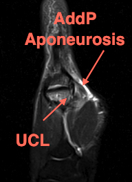 MRI Anatomy