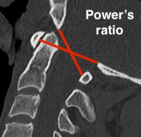 Powers ratio