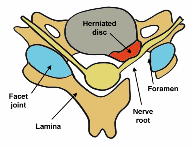 Foramen