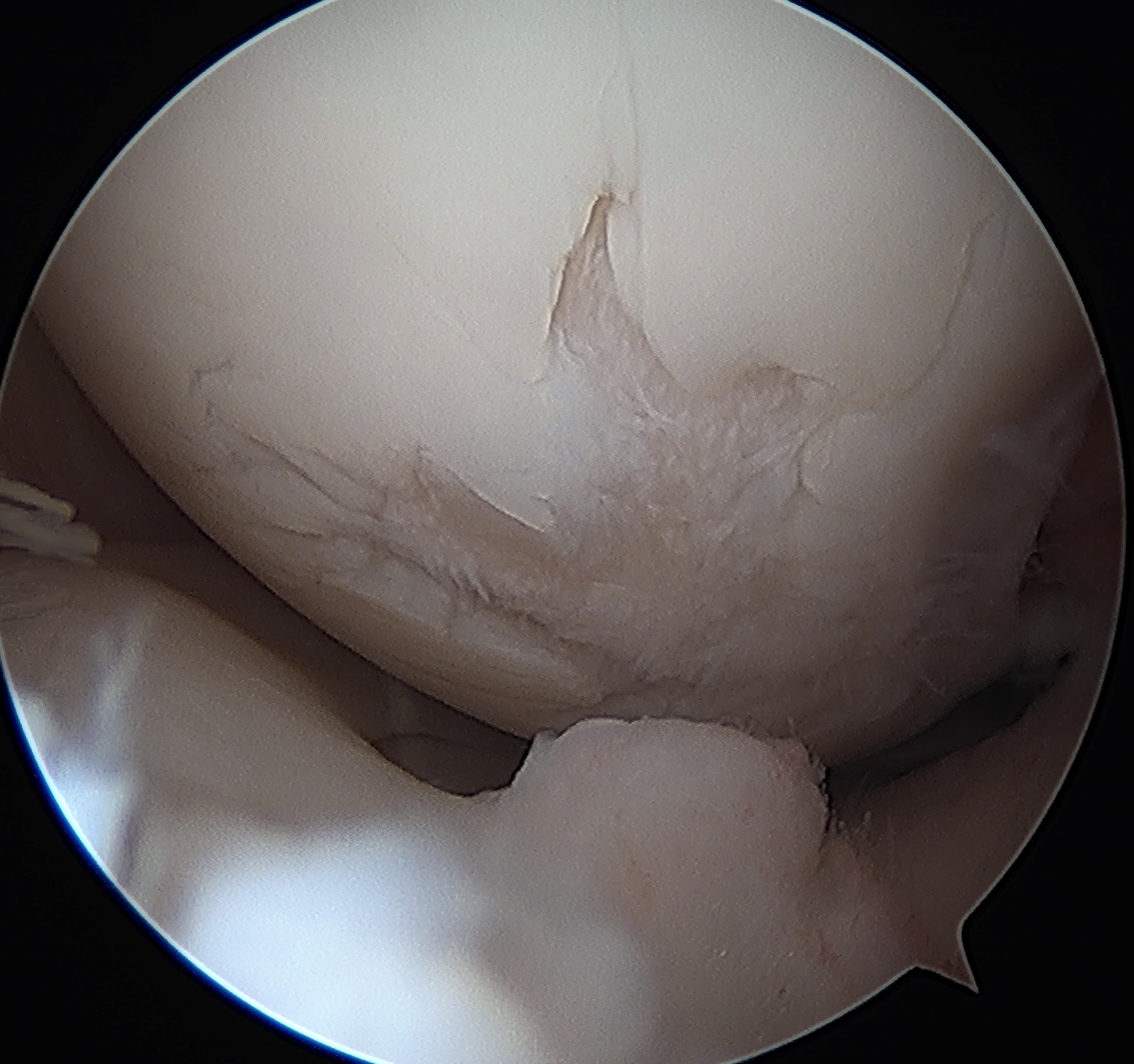 Cartilage image